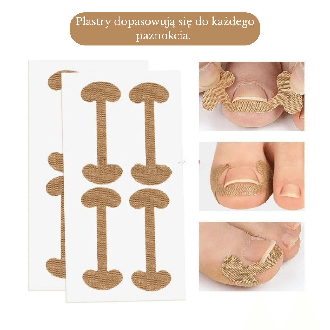 Stovio – Plastry wspierające prawidłowe ułożenie paznokcia