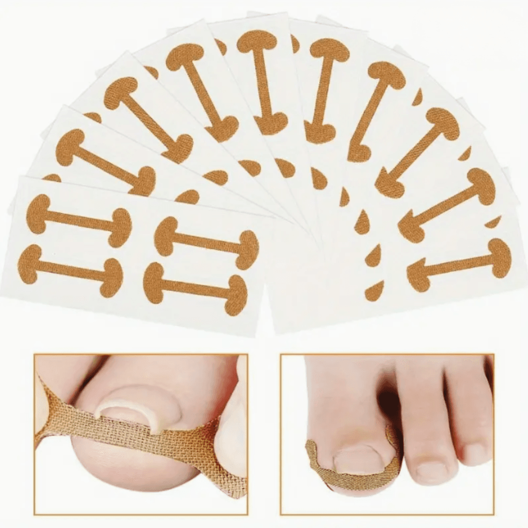 Stovio – Plastry wspierające prawidłowe ułożenie paznokcia