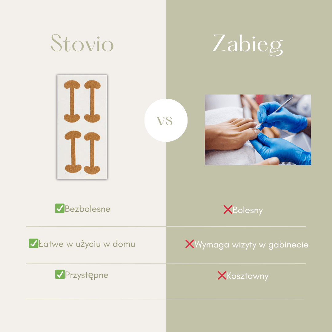 Stovio – Plastry wspierające prawidłowe ułożenie paznokcia